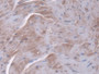 DAB staining on IHC-P; Samples: Mouse Heart Tissue; Primary Ab: 20µg/ml Rabbit Anti-Mouse PPIF Antibody Second Ab: 2µg/mL HRP-Linked Caprine Anti-Rabbit IgG Polyclonal Antibody