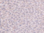 DAB staining on IHC-P; Samples: Mouse Liver Tissue.