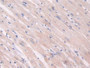DAB staining on fromalin fixed paraffin- embedded heart tissue)