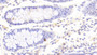 DAB staining on IHC-P. Samples: Human Tissue)