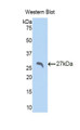 Western Blot; Sample: Recombinant protein.