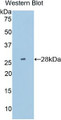 Western Blot; Sample: Recombinant protein.