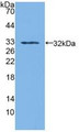Western Blot; Sample: Recombinant SDH, Human.