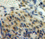 Used in DAB staining on fromalin fixed paraffin-embedded ovary tissue