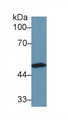 Western Blot; Sample: Human Lung lysate; Primary Ab: 1µg/ml Rabbit Anti-Human NNE Antibody Second Ab: 0.2µg/mL HRP-Linked Caprine Anti-Rabbit IgG Polyclonal Antibody