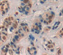 Breast Cancer Susceptibility Protein 2 (BRCA2) Polyclonal Antibody, Cat#CAU26077