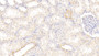 DAB staining on IHC-P; Samples: Human Kidney Tissue;  Primary Ab: 20μg/ml Rabbit Anti-Human AhR Antibody Second Ab: 2µg/mL HRP-Linked Caprine Anti-Rabbit IgG Polyclonal Antibody 