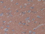DAB staining on IHC-P; Samples: Human Brain Tissue.