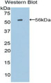 Western Blot; Sample: Recombinant protein.
