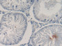 DAB staining on IHC-P; Samples: Rat Testis Tissue)