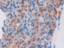 DAB staining on fromalin fixed paraffin- embedded heart tissue)