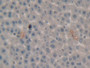 DAB staining on IHC-P; Samples: Rat Liver Tissue; Primary Ab: 20µg/ml Rabbit Anti-Rat Plg Antibody Second Ab: 2µg/mL HRP-Linked Caprine Anti-Rabbit IgG Polyclonal Antibody