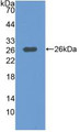 Western Blot; Sample: Recombinant MAP3K1, Human.