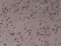 DAB staining on IHC-P; Samples: Human Brain Tissue
