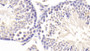 DAB staining on IHC-P; Samples: Mouse Testis Tissue;  Primary Ab: 20μg/ml Rabbit Anti-Mouse MAP4K5 Antibody Second Ab: 2µg/mL HRP-Linked Caprine Anti-Rabbit IgG Polyclonal Antibody 