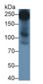 Western Blot; Sample: Rat Vein lysate; Primary Ab: 3μg/ml Rabbit Anti-Human MCSP Antibody; Second Ab: 0.2µg/mL HRP-Linked Caprine Anti-Rabbit IgG Polyclonal Antibody;