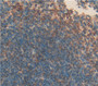 Used in DAB staining on fromalin fixed paraffin- embedded Kidney tissue