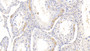 DAB staining on IHC-P; Samples: Bovine Testis Tissue; Primary Ab: 20μg/ml Rabbit Anti-Bovine HSPA1A Antibody Second Ab: 2µg/mL HRP-Linked Caprine Anti-Rabbit IgG Polyclonal Antibody