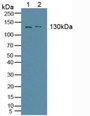 Western Blot; Sample: Lane1: Human Serum; Lane2: Human Liver Tissue.