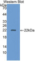 Western Blot; Sample: Recombinant AAP, Human.