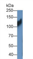 Western Blot; Sample: HT1080 cell lysate; Primary Ab: 1µg/ml Rabbit Anti-Mouse ITGb1 Antibody; Second Ab: 0.2µg/mL HRP-Linked Caprine Anti-Rabbit IgG Polyclonal Antibody;