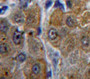 Used in DAB staining on fromalin fixed paraffin-embedded Liver tissue