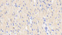 DAB staining on IHC-P; Samples: Human Cardiac Muscle Tissue;  Primary Ab: 20μg/ml Rabbit Anti-Human ACVR1 Antibody Second Ab: 2µg/mL HRP-Linked Caprine Anti-Rabbit IgG Polyclonal Antibody 