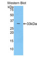 Western Blot; Sample: Recombinant protein.