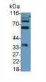 Western Blot; Sample: Recombinant protein.