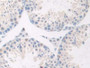 DAB staining on IHC-P; Samples: Mouse Testis Tissue; Primary Ab: 20µg/ml Rabbit Anti-Mouse GnRH Antibody Second Ab: 2µg/mL HRP-Linked Caprine Anti-Rabbit IgG Polyclonal Antibody