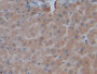 DAB staining on IHC-P; Samples: Human Liver Tissue; Primary Ab: 20µg/ml Rabbit Anti-Human TNFSF14 Antibody Second Ab: 2µg/mL HRP-Linked Caprine Anti-Rabbit IgG Polyclonal Antibody