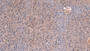 DAB staining on IHC-P; Samples: Mouse Liver Tissue; Primary Ab: 10µg/ml Rabbit Anti-Mouse F2 Antibody Second Ab: 2µg/mL HRP-Linked Caprine Anti-Rabbit IgG Polyclonal Antibody