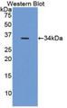 Western Blot; Sample: Recombinant HIF1a, Human.