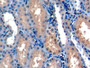 DAB staining on fromalin fixed paraffin-embedded Kidney tissue)