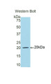 Western Blot; Sample: Recombinant protein.