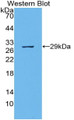 Western Blot; Sample: Recombinant protein.