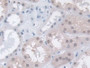 DAB staining on IHC-P; Samples: Human Kidney Tissue; Primary Ab: 10µg/ml Rabbit Anti-Human MPP5 Antibody Second Ab: 2µg/mL HRP-Linked Caprine Anti-Rabbit IgG Polyclonal Antibody