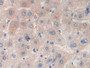 DAB staining on IHC-P; Samples: Human Liver Tissue.