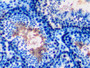 DAB staining on IHC-P; Samples: Mouse Testis Tissue; Primary Ab: 10µg/ml Rabbit Anti-Mouse GPI Antibody Second Ab: 2µg/mL HRP-Linked Caprine Anti-Rabbit IgG Polyclonal Antibody