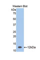 Western Blot; Sample: Recombinant protein.