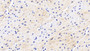 DAB staining on IHC-P;&lt;br/&gt;Samples: Human Cardiac Muscle Tissue; &lt;br/&gt;Primary Ab: 20μg/ml Rabbit Anti-Human Hsp27 Antibody&lt;br/&gt;Second Ab: 2µg/mL HRP-Linked Caprine Anti-Rabbit IgG Polyclonal Antibody&lt;br/&gt;