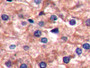 DAB staining on IHC-P; Samples: Porcine Liver Tissue)