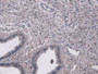 DAB staining on IHC-P; Samples: Mouse Uterus Tissue