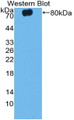 Western Blot; Sample: Recombinant protein.