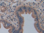 DAB staining on fromalin fixed paraffin- embedded Kidney tissue)