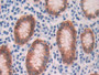 DAB staining on IHC-P; Samples: Human Stomach Tissue; Primary Ab: 10µg/ml Rabbit Anti-Human ADH1 Antibody Second Ab: 2µg/mL HRP-Linked Caprine Anti-Rabbit IgG Polyclonal Antibody
