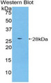 Western Blot; Sample: Recombinant protein.