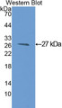 Western Blot; Sample: Recombinant protein.