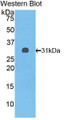 Western Blot; Sample: Recombinant protein.