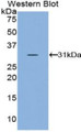 Western Blot; Sample: Recombinant protein.